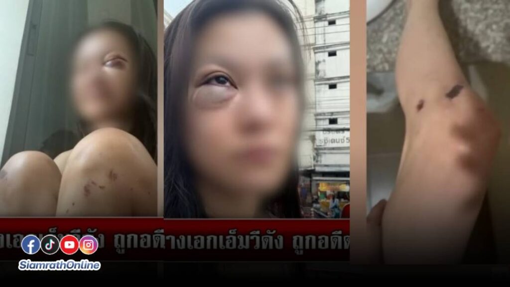 ทำร้าย