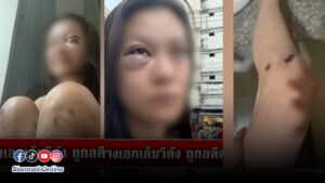 ทำร้าย