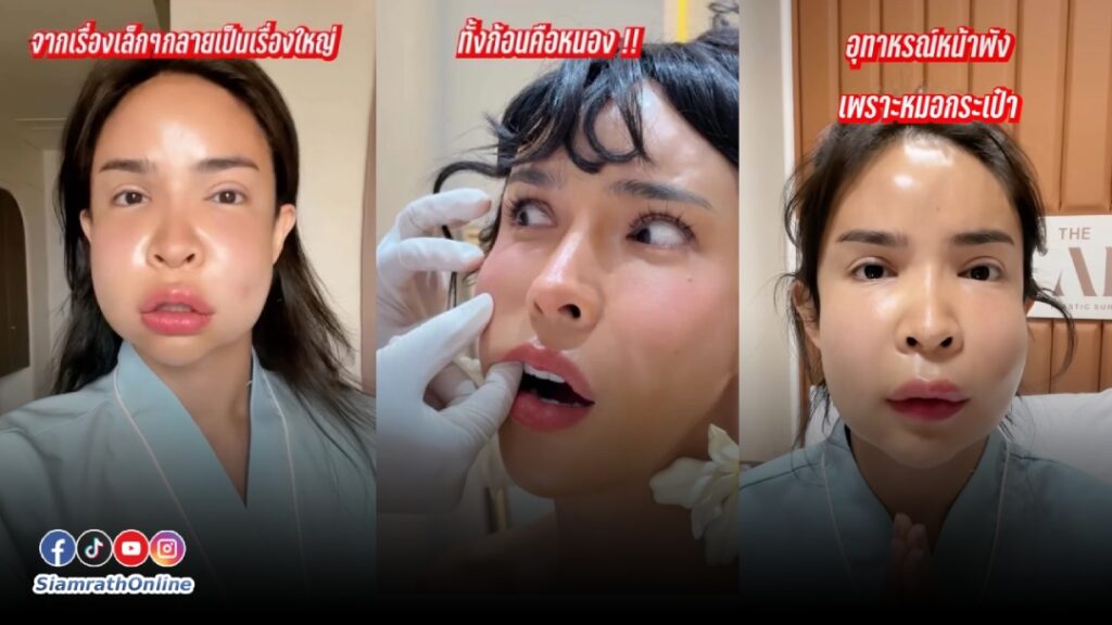 พี่นัท