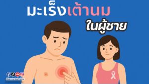 มะเร็ง
